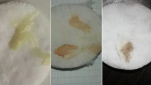 Могут ли у подростков быть коричневые выделения перед месячными