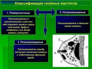 Гнойный нелактационный мастит лечение антибиотиками