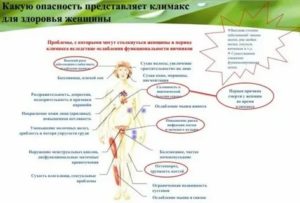 Чем лечить климактерический цистит