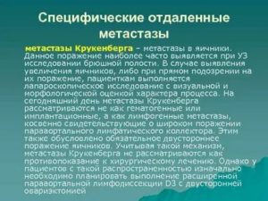 Метастазы в яичники крукенберга это