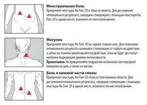 Когда болит спина и месячных нет что это значит