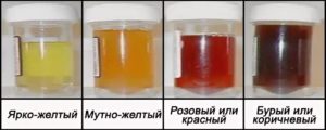 Что если при месячных моча коричневая