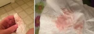Что означают розоватые выделения за несколько дней до месячных