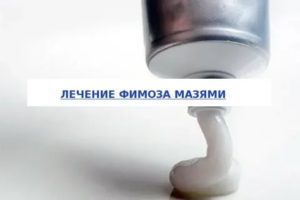 Мазь от фимоза растянуть