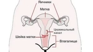 Цервикальный канал сомкнут это бесплодие