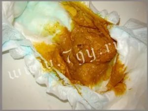 Может ли при молочнице быть понос