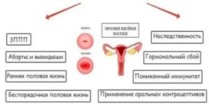 Цитологическая картина эктопии шейки матки что это такое