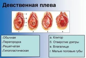 Девственная плева можно ли увидеть на узи