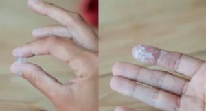 Жидкие как вода выделения при молочнице