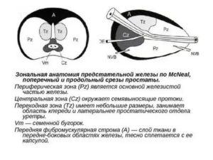 Что означает neo предстательной железы tзnхmх