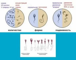 Как влияют антибиотики на сперму при зачатии