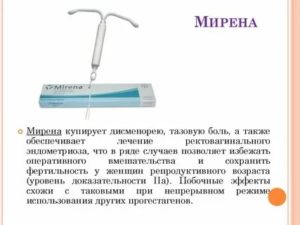 Спираль мирена при эндометриозе отзывы врачей специалистов при эндометриозе