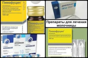 Молочница при сахарном диабете у женщин симптомы лечение