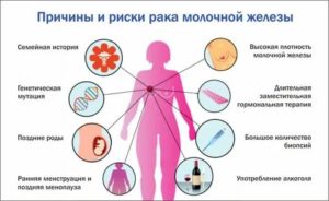 Психологические причины возникновения рака молочной железы