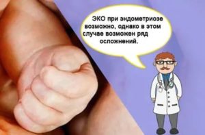 Эко при эндометриозе у кого получилось отзывы