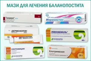 Какие принимать антибиотики при воспалении крайней плоти