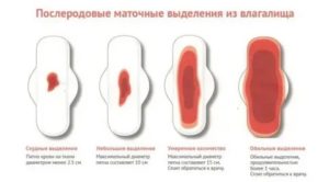 Когда появляются месячные после кесарева и какие они