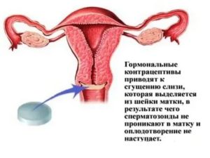 Когда начинается менструация после отмены оральных контрацептивов