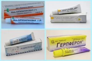 Таблетки от зуда полового органа