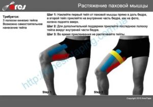Препарат для паховых связок