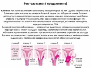 Рак матки первые признаки и симптомы в пожилом возрасте