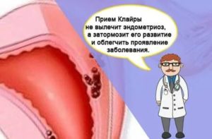 Клайра отзывы женщин после 40 лет при эндометриозе и при миоме матки