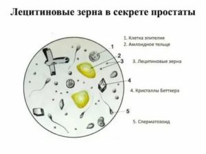 Что такое лецитиновые зерна в анализе секрета предстательной железы