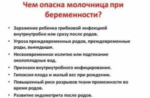 Причины молочницы перед родами