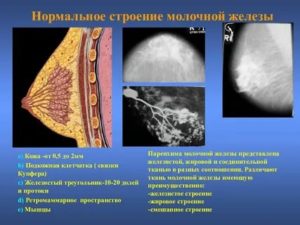 Узи молочных желез показало преимущественно жировая железистая ткань