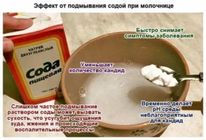 Можно ли подмываться хозяйственным мылом при молочнице при беременности