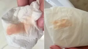 Что означают розоватые выделения за несколько дней до месячных