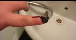 Могут ли начаться месячные через неделю после выкидыша