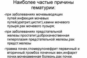 Лечение антибиотиками при гематурии у мужчин