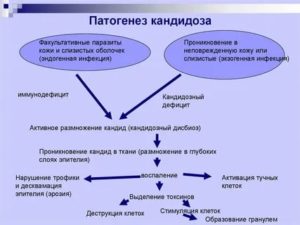 Этиология и патогенез кандидоза полости рта