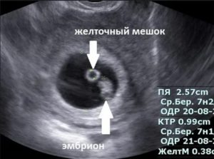 На какой недели в матке виден плод на узи