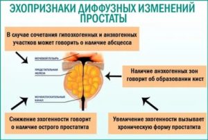 Эхографические признаки хронического простатита что это такое