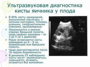 Что такое киста яичника у плода в 32 недели