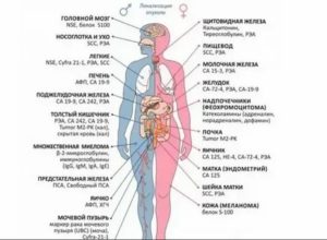 Опухоль яичка онкомаркеры в норме может ли быть рак