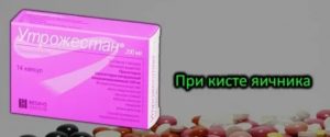 Для чего назначают новинет при кисте яичника