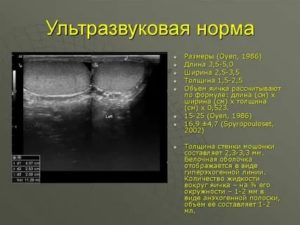 Узи органов мошонки или узи органов мошонки с допплерографией сосудов