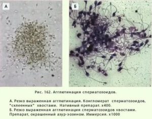 Агглютинация сперматозоидов витамин с