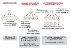 Наследственная форма рака молочной железы генетические причины