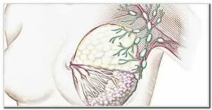 Могут ли воспаляться лимфоузлы при эндометриозе