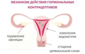 Могут ли идти месячные при приеме противозачаточных в середине цикла