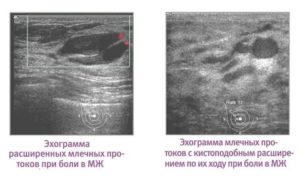 Нормы времени на узи молочных желез