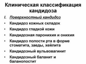 Классификация урогенитального кандидоза