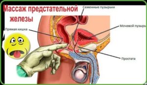 Должны ли быть боли при массаже предстательной железы