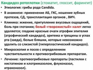 Лечение ротоглоточного кандидоза