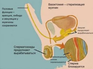 Может ли у кастрированного мужчины быть эрекция