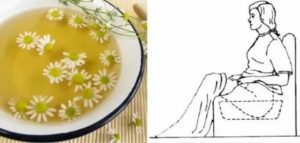 Ванночки с ромашкой при эндометриозе